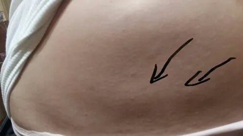 Уплотнение с правой стороны