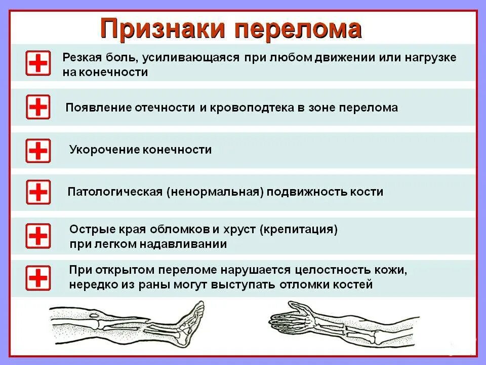 Признаки открытого и закрытого перелома. Основные симптомы перелома костей конечностей. Общие признаки перелома кости конечности. Признаки закрытого перелома кости.