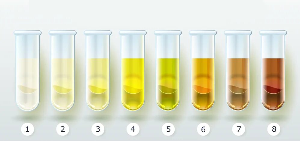 Моча при молочнице. Urine Color.