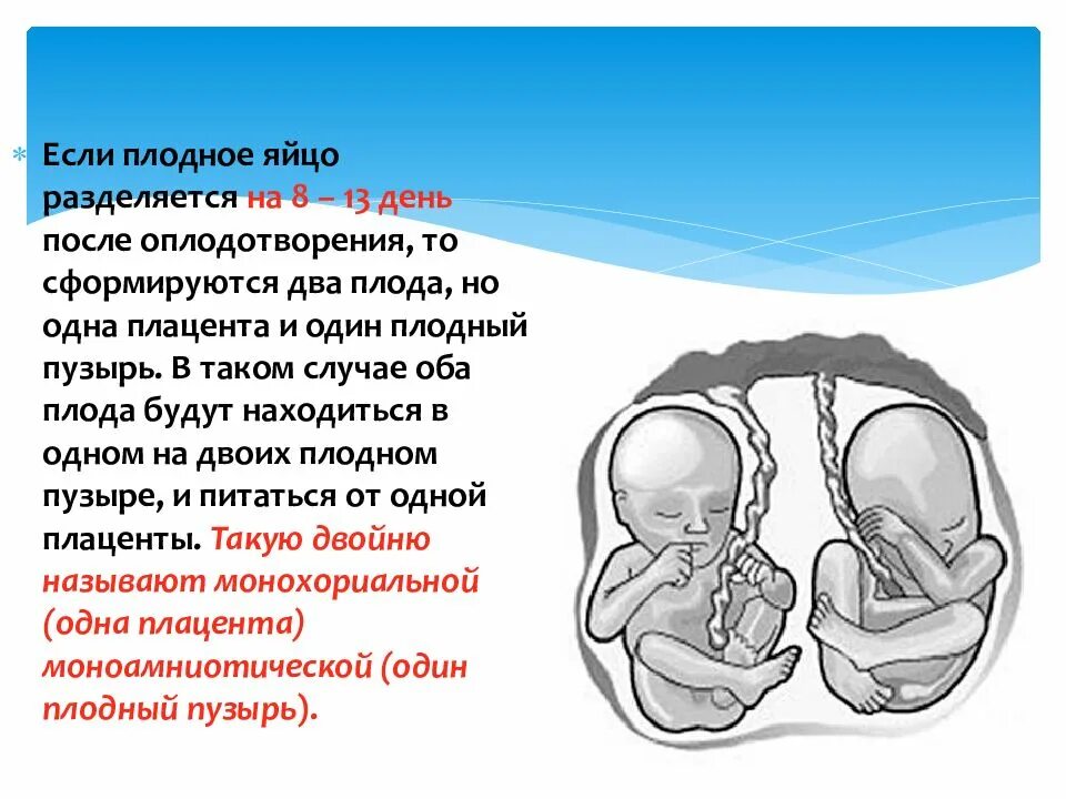 Многоплодная беременность. Многоплодие презентация. Многоплодная беременность презентация. Маловодии 38 неделя