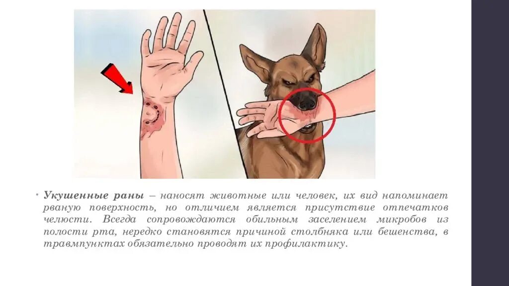 Чем обрабатывать рану после укуса