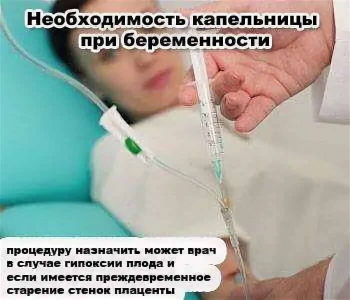Капельница перед родами. Внутривенно при токсикозе при беременности. капельница от токсикоза при беременности на ранних. капельница в беременность.