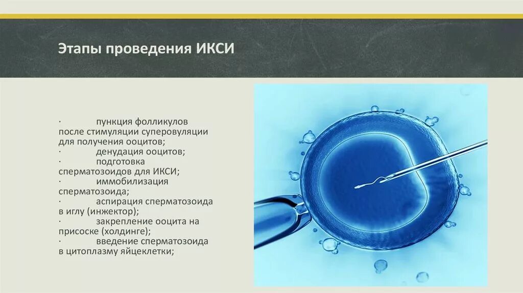 Оплодотворение яйцеклетки ИКСИ. Оплодотворение ооцитов методом ИКСИ. Эко ИКСИ. Этапы ИКСИ.