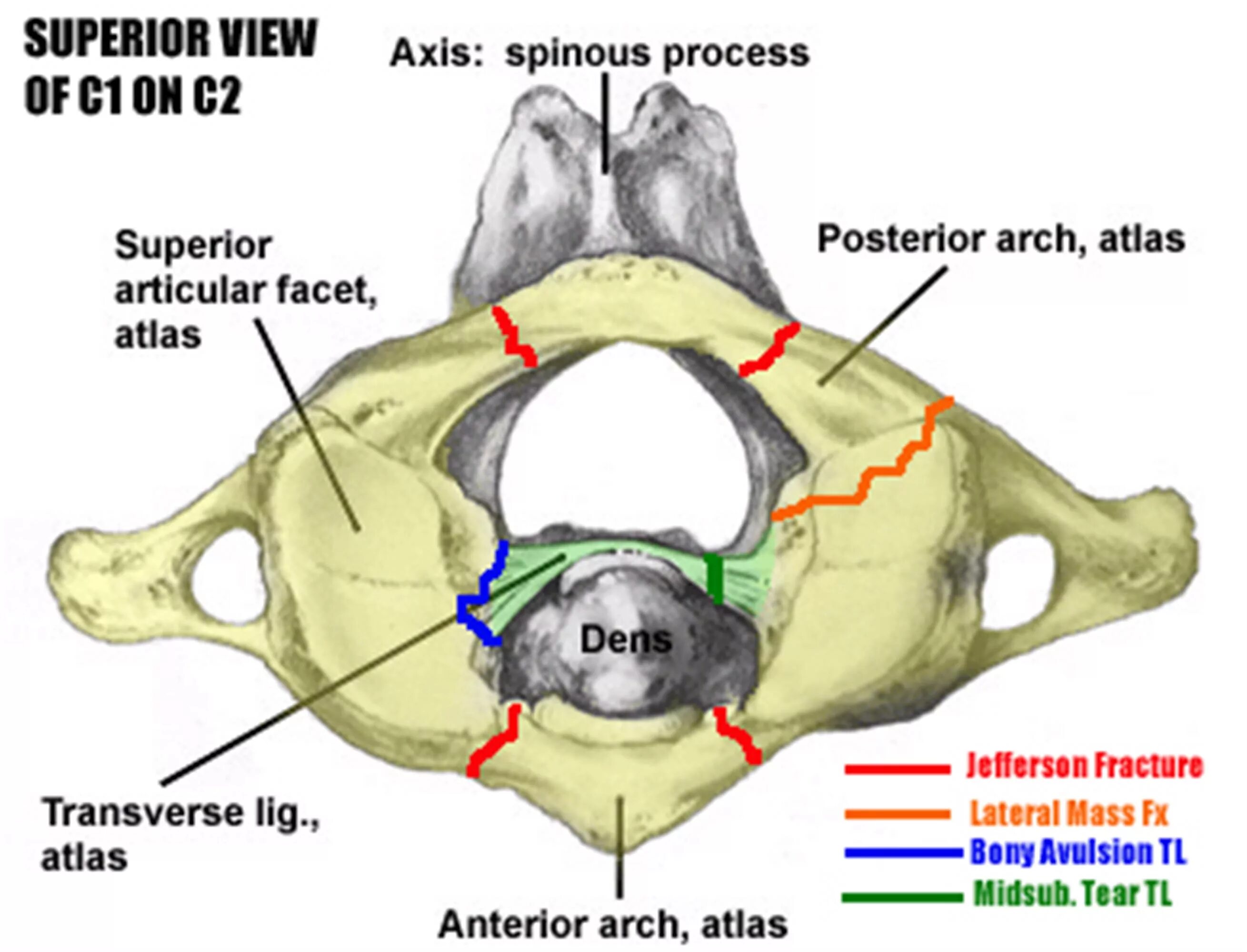 Аксис анатомия. Atlas dens Axis. C1 vertebrae. Superior view перевод