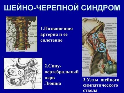 Черепные позвоночные