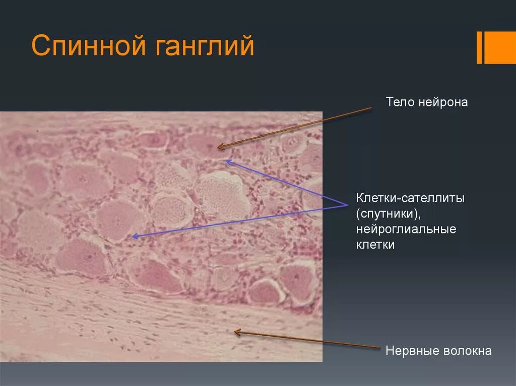 Спинальный ганглий гистология препарат. Спинномозговой ганглий гистология препарат. Клетки спинального ганглия строение. Нервный ганглий гистология.