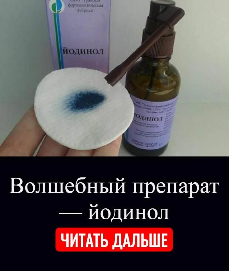 Йодинол лечение. Йодинол спрей для горла. йодинол пшикалка. йодинол раствор для полоскания. препарат синего цвета для горла.