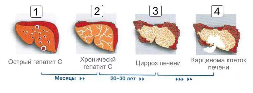 Печень а б д