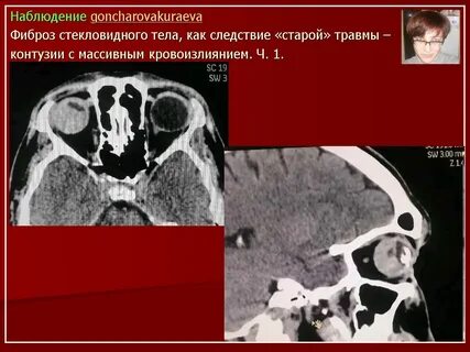 Что дает кт
