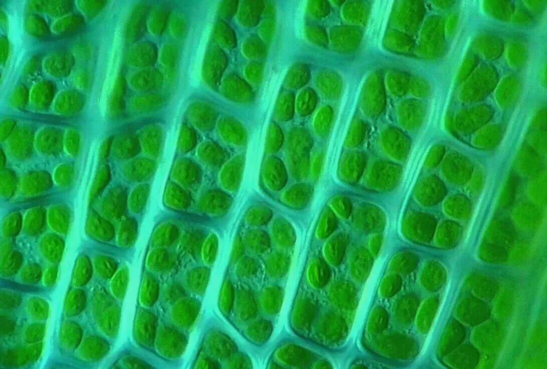 Хлоропласты в клетках листьев крупные. Хлоропласт в микроскопе. Хлоропласт микрофотография. Хлоропласт под микроскопом. Хлоропласты листа под микроскопом.