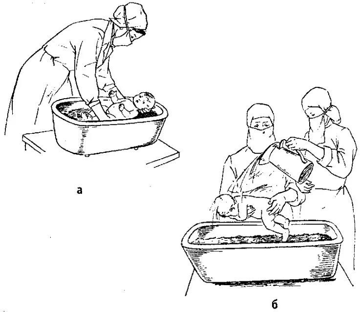 Подмывание новорожденного алгоритм. Подмывание грудного ребенка алгоритм. Проведение гигиенической ванны новорожденному алгоритм. Алгоритм проведения подмывания новорожденных. Ванна ребенка алгоритм