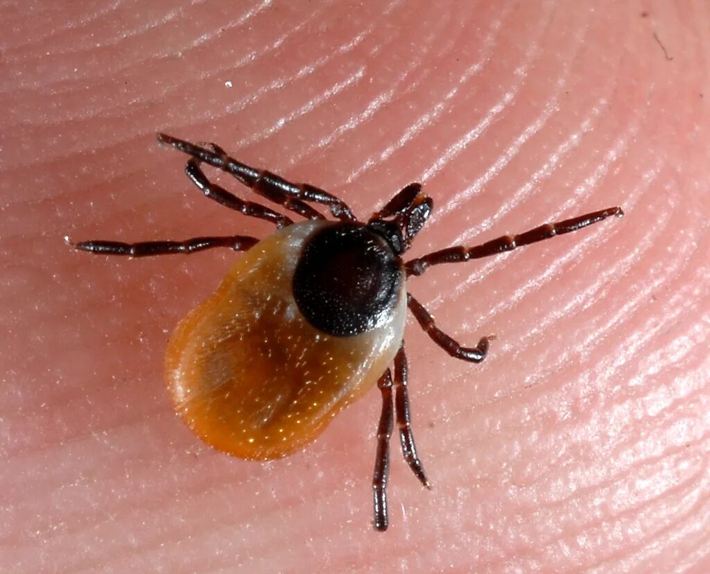 Tackling the tricky task of tick removal Tick removal, Ticks, Tackle