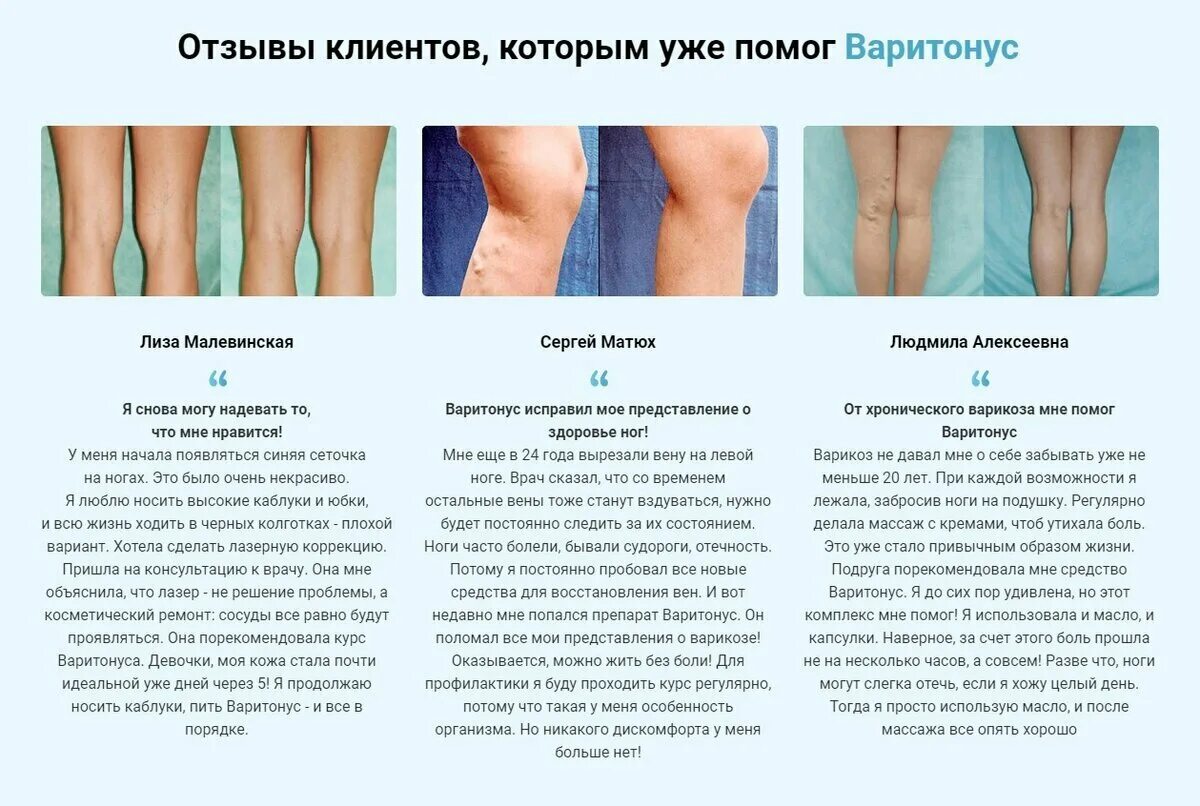 После массажа можно есть. Варикоз вен нижних конечностей. Варикозное расширение ног. Варикозное расширение вен голени.