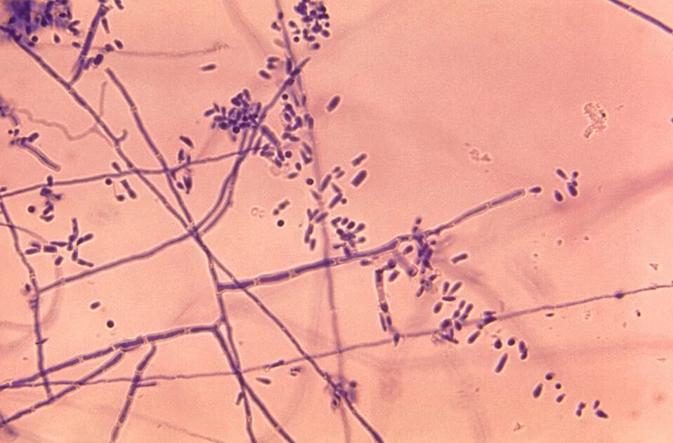 Нити мицелия споры. Грибы кандида микроскопия. Trichophyton equinum микроскопия. Мицелий кандида в мазке. Мицелий гриба микроскопия.