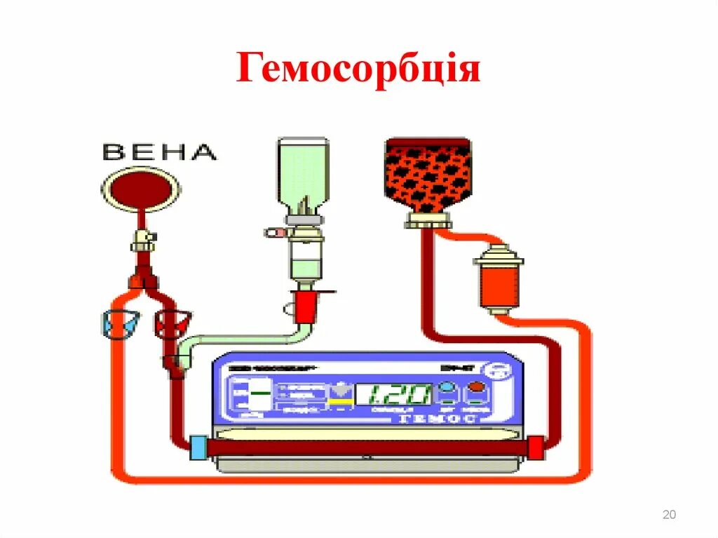 Гемос пф. Гемосорбция. схема проведения гемосорбции. устройство для гемосорбции.