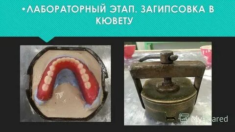 Гипсовка в кювету