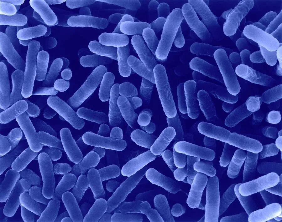 Legionella pneumophila микробиология. Легионелла. Бактерия легионелла. Возбудитель легионеллы. Легионелла.