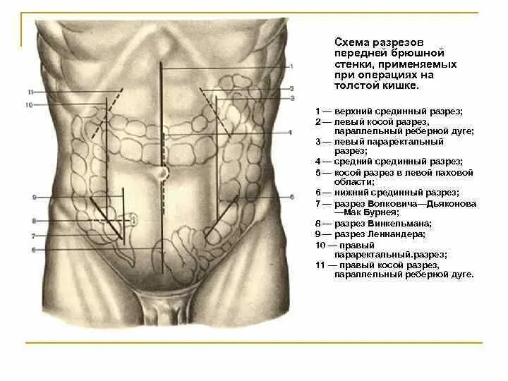 Брюшная стенка после операции. Параректальный разрез передней брюшной стенки. Анатомия брюшной полости человека схема расположения у мужчин. Область пупка анатомия передней брюшной стенки. Срединный разрез брюшной полости.