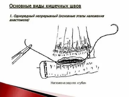 Кишечные швы топографическая анатомия
