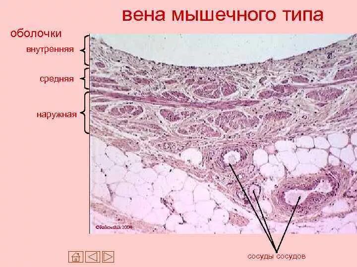 Вены мышечного типа примеры Презентация на тему: Однослойный