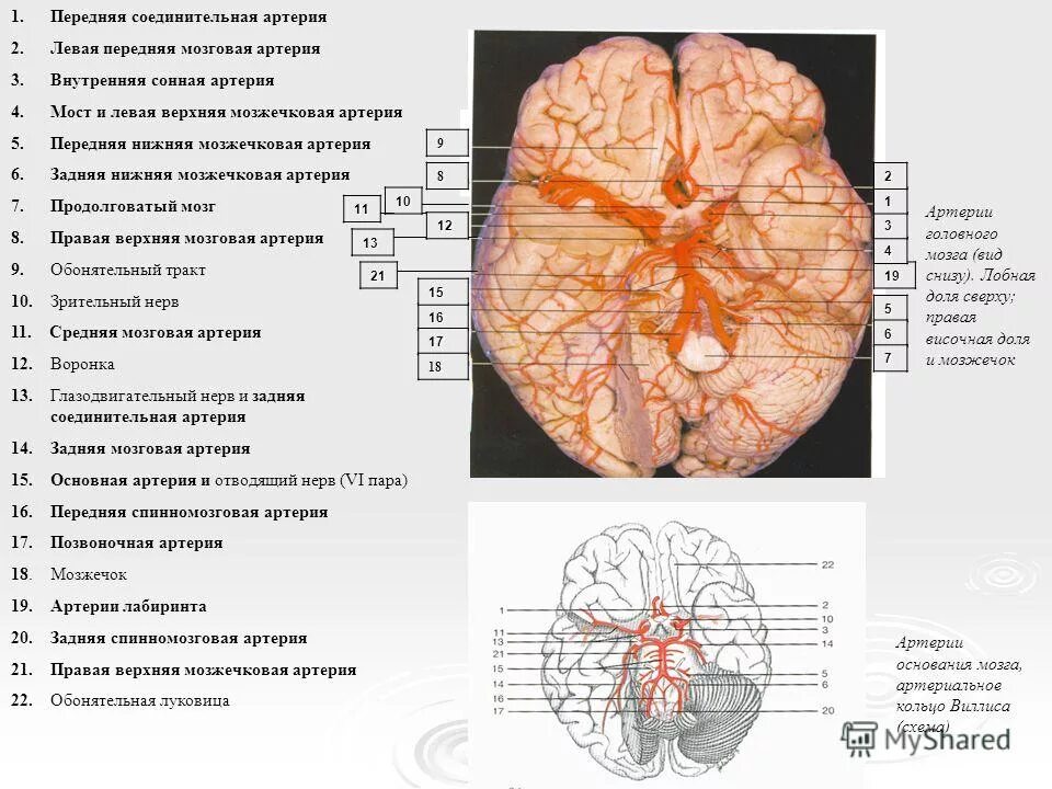 Задние соединительные артерии кт. Передняя соединительная мозговая артерия. Кровоснабжение мозжечка схема. Задняя нижняя мозжечковая артерия на кт. Мозговые артерии латынь