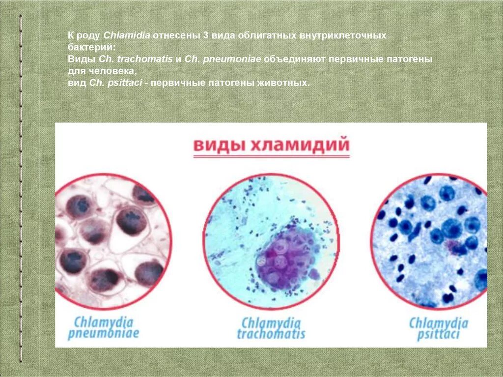Хламидии форма бактерии. Урогенитальный хламидиоз морфология. Хламидии trachomatis микробиология. Хламидии метод окраски.