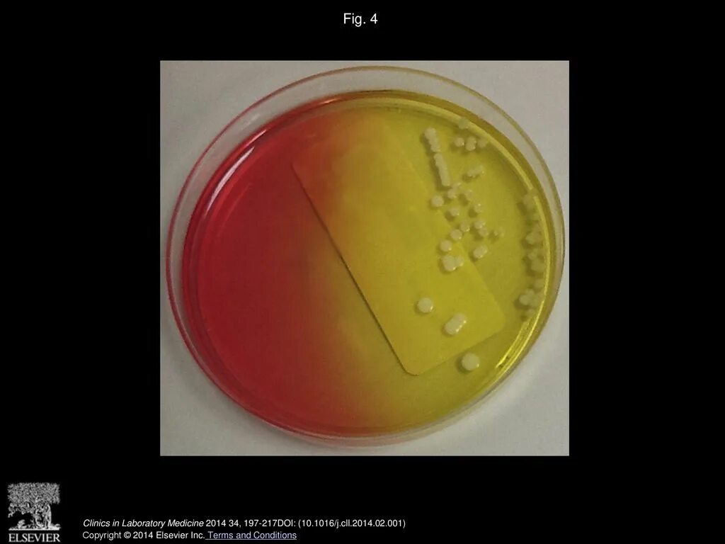 Стафилококк aureus в моче. Staphylococcus haemolyticus в моче. Стафилококки и стрептококки в моче. Микроорганизм в моче Staphylococcus epidermidis. Staphylococcus aureus 10 4