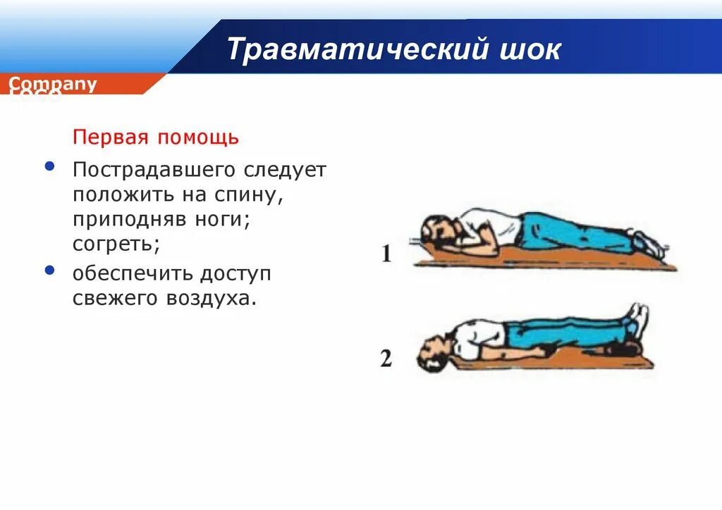 Травм шок первая помощь. Положение пострадавшего при шоке. Травматический ШОК. Транспортировка пострадавшего при травматическом шоке.