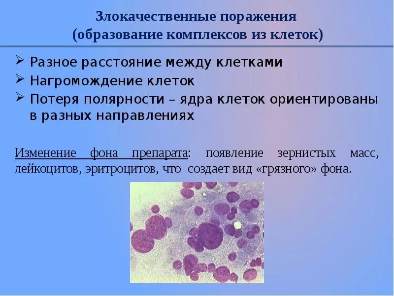 Что означает интраэпителиальное поражение