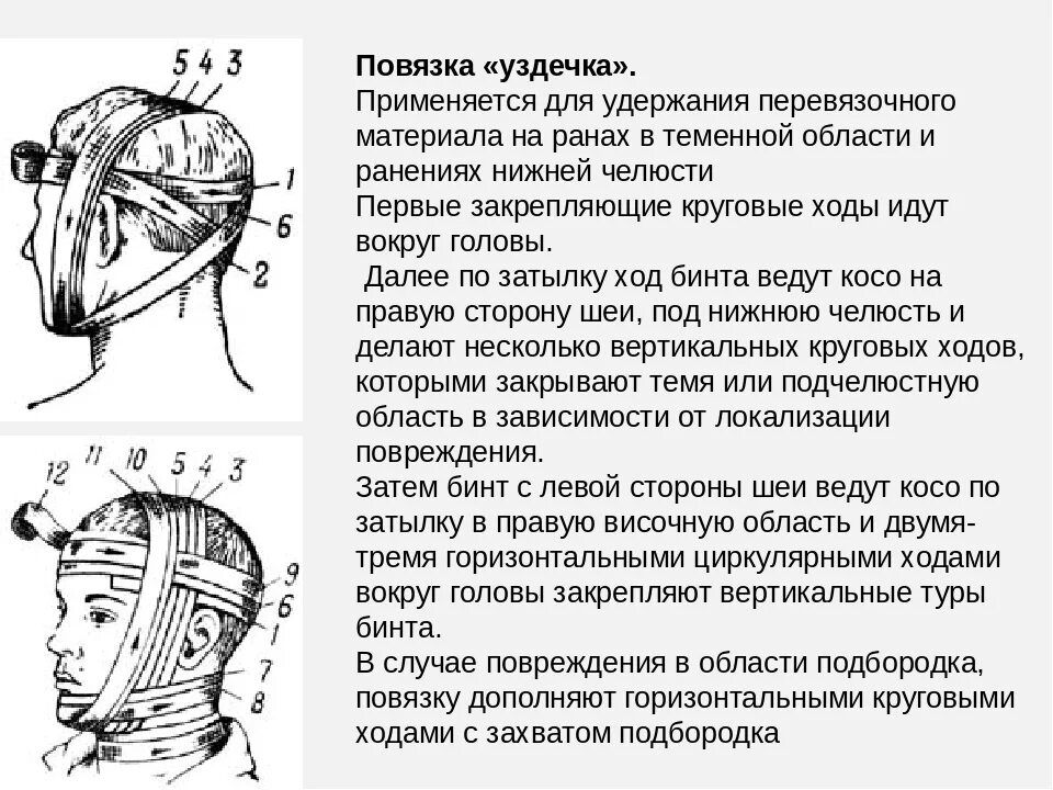 Повязка накладывается при повреждении затылка. Наложение повязки уздечка алгоритм. Повязка уздечка техника наложения. Продемонстрируйте технику наложения повязки «уздечка».. Десмургия повязка уздечка.