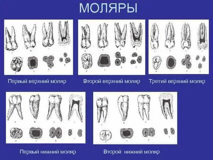 Третий моляр верхней