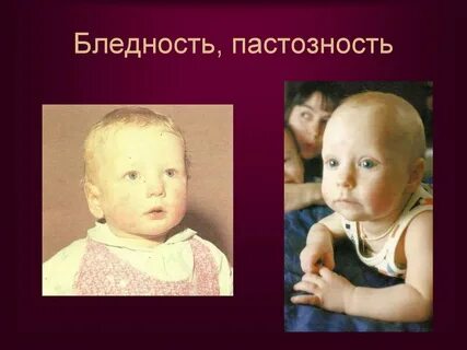 Аномалии конституции