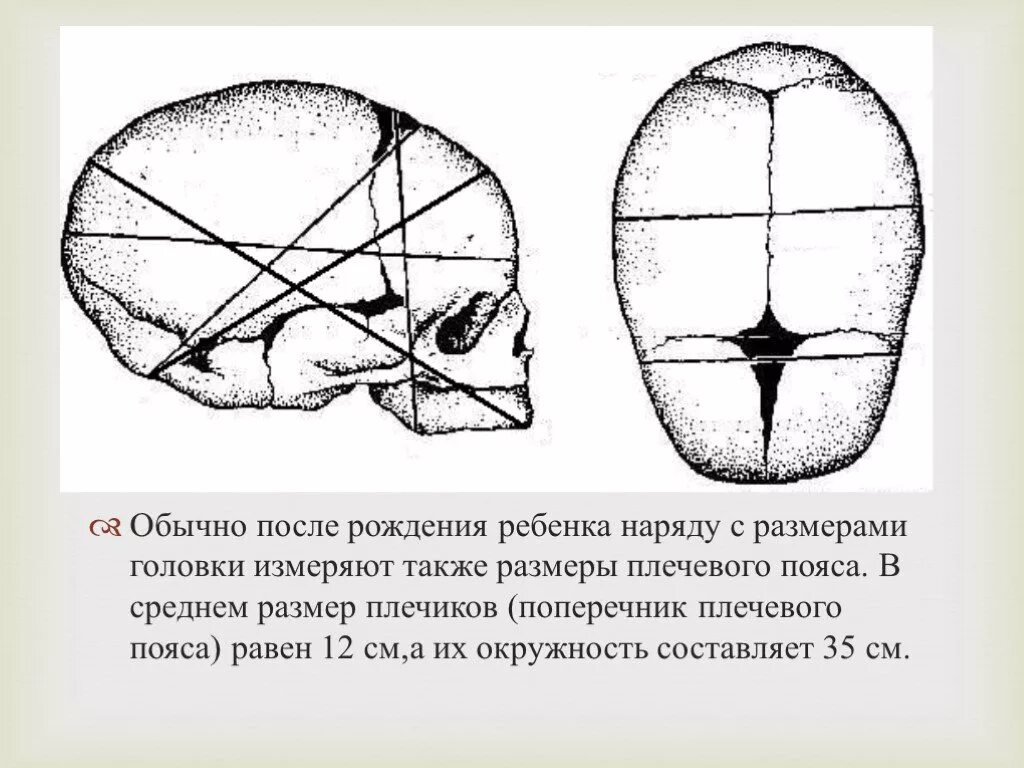 Швы и роднички черепа новорожденного. Швы и роднички головки плода. Роднички черепа плода. Сагиттальный шов черепа новорожденного.