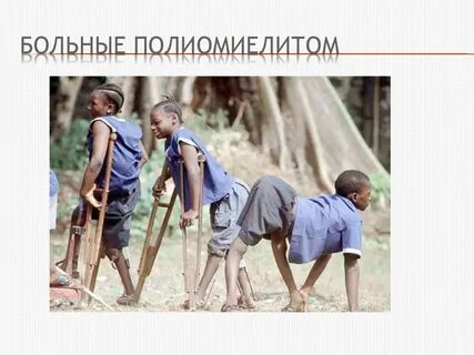 Полиомиелита заболел
