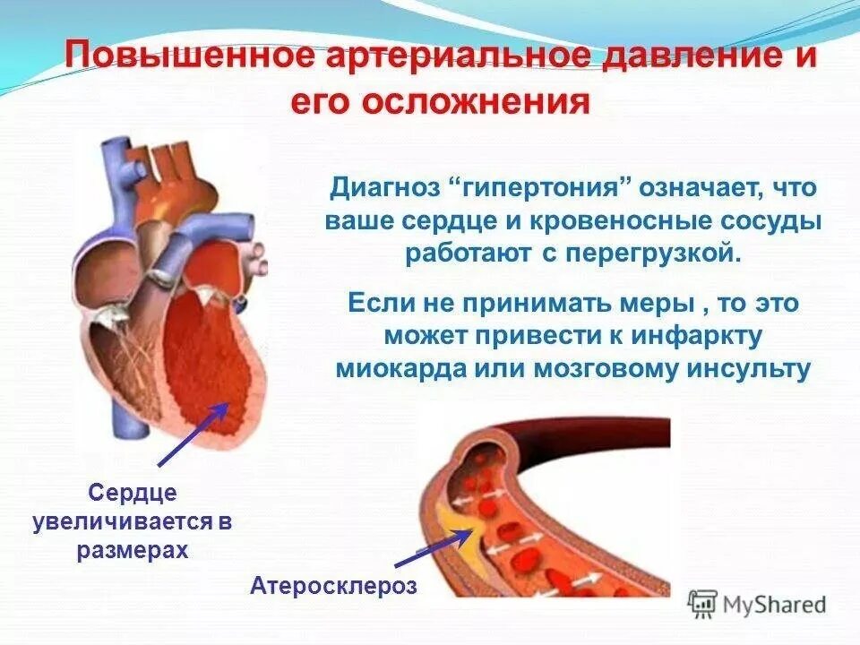 При сужении сосудов давление. Артериальная гипертензия. Артериальная гипертензия сердце. Сосуды при артериальной гипертензии. Сердце при артериальной гипертонии.