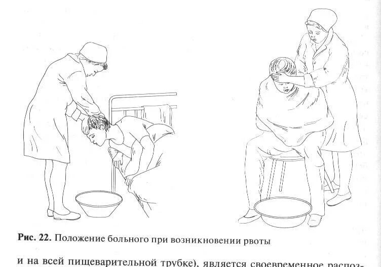 Положение больного при рвоте. Памятка пациенту при рвоте. Оказание помощи при рвоте. Положение пациента при рвоте. Оказание помощи при рвоте алгоритм