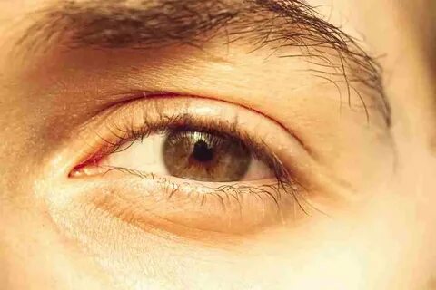 Direct eye
