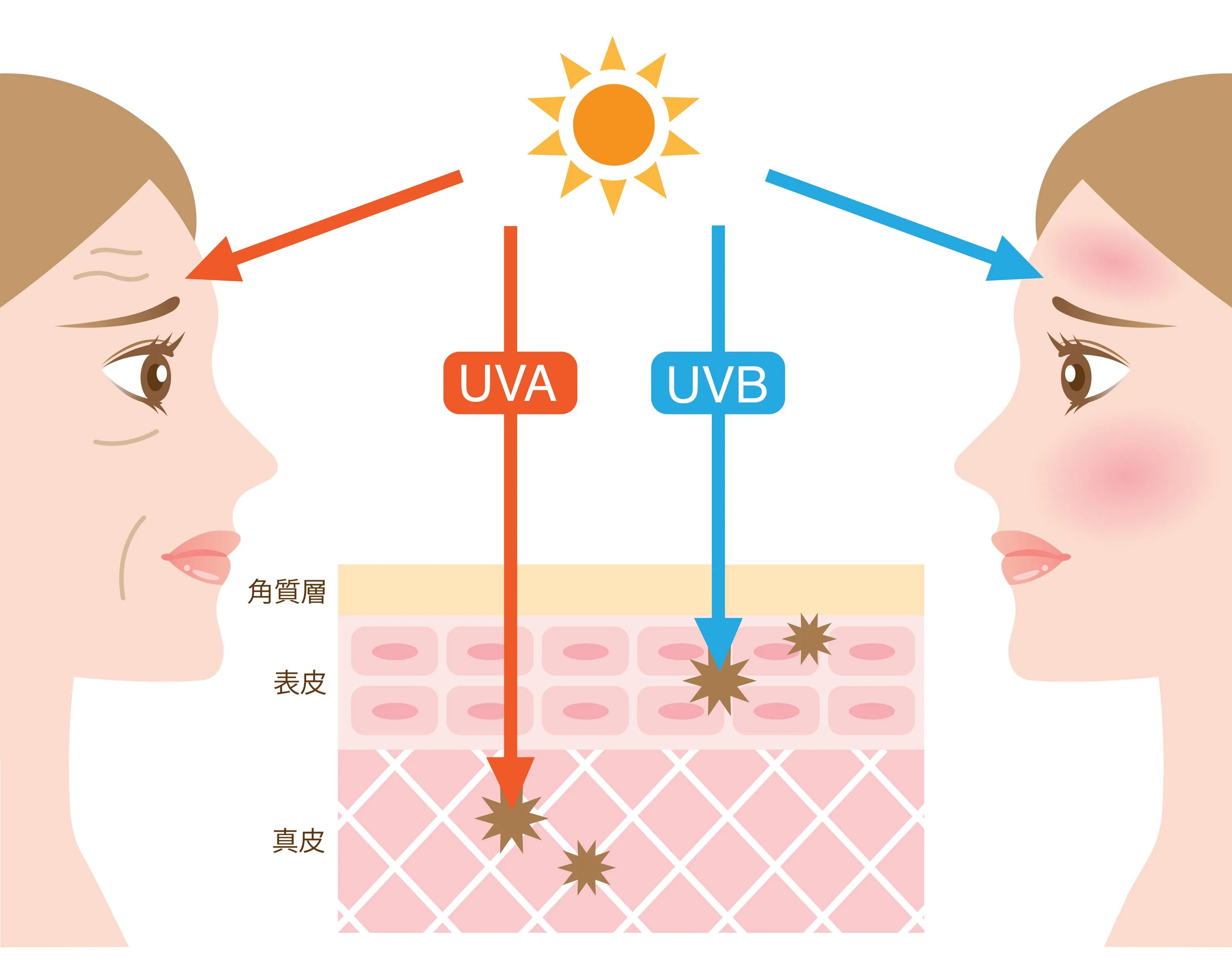 Лучи ультрафиолетовые UVA UVB. UVA UVB лучи схема. UVA UVB лучи что это. Воздействие УФ лучей на кожу.