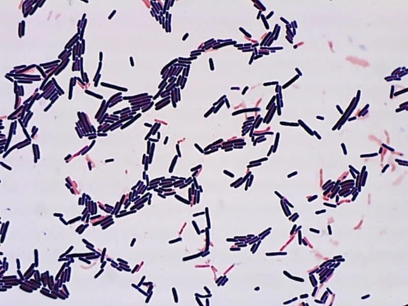 Палочка бифидобактерии. Молочнокислые бактерии лактобациллы. Лактобациллы палочки Дедерлейна. Lactobacillus Acidophilus микроскопия. Ацидофильные лактобактерии (Lactobacillus Acidophilus).
