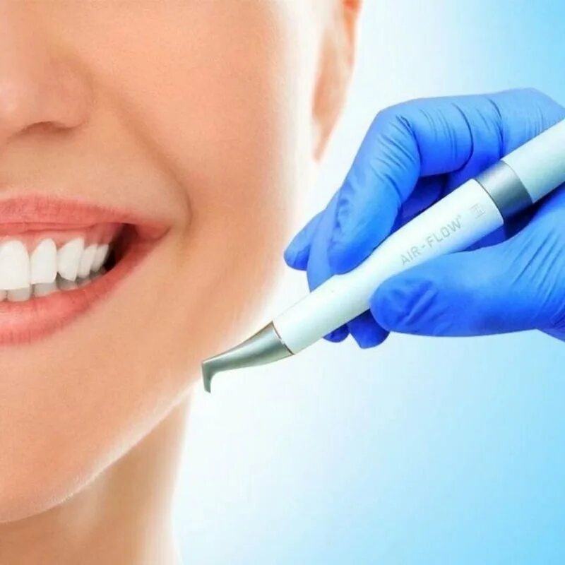 Чистка айр фло. Профгигиена полости рта Air Flow. Dental Air Flow стоматологический. Профгигиена (ультразвук + Air-Flow). АИР флоу в стоматологии.