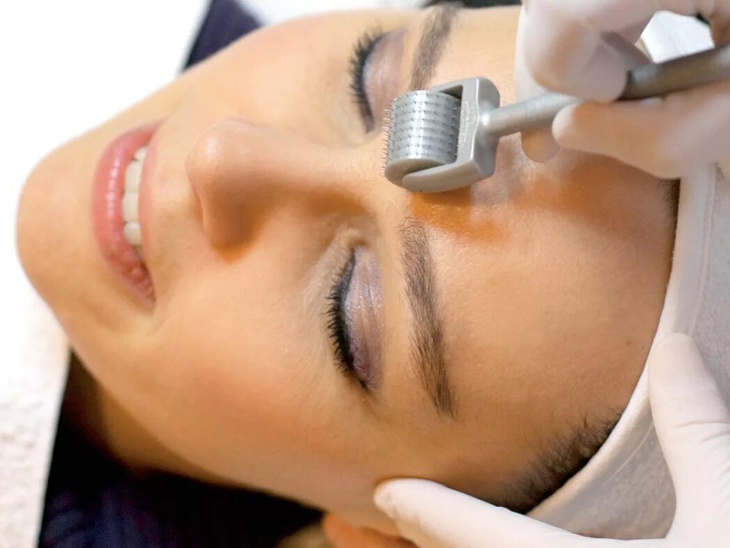 Косметология инъекции. Биорепарация. Безинъекционная мезотерапия мезороллером. Протокол процедуры фракционной мезотерапии лица. Фракционная микроигольчатая мезотерапия.