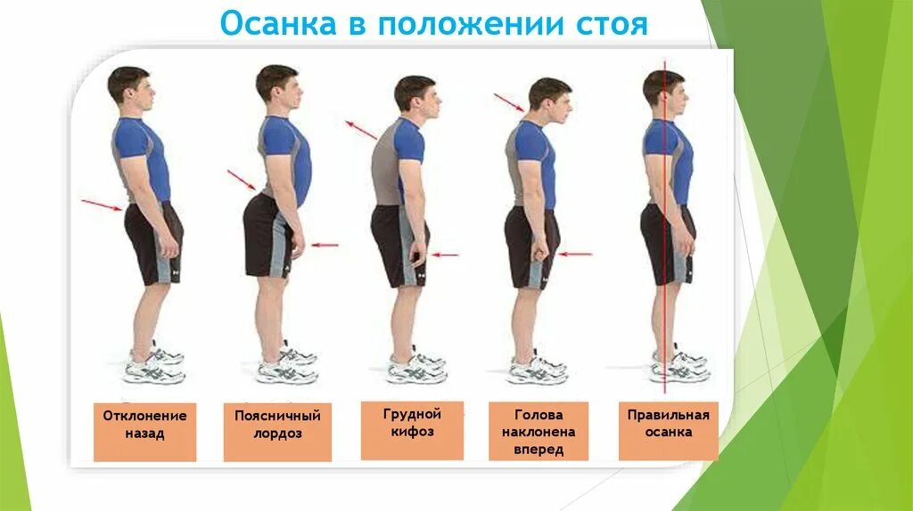 Почему стоя становится плохо. Правильная осанка в положении стоя. Правильное положение осанки. Осанка в положении стоя. Правильное положение позвоночника.