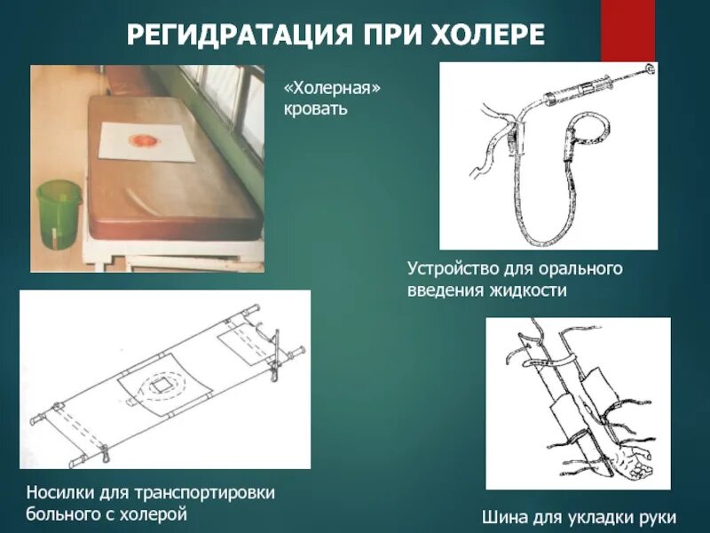 Помощь при холере. Кровать для больного холерой. регидратация при холере. принципы регидратационной терапии при холере.