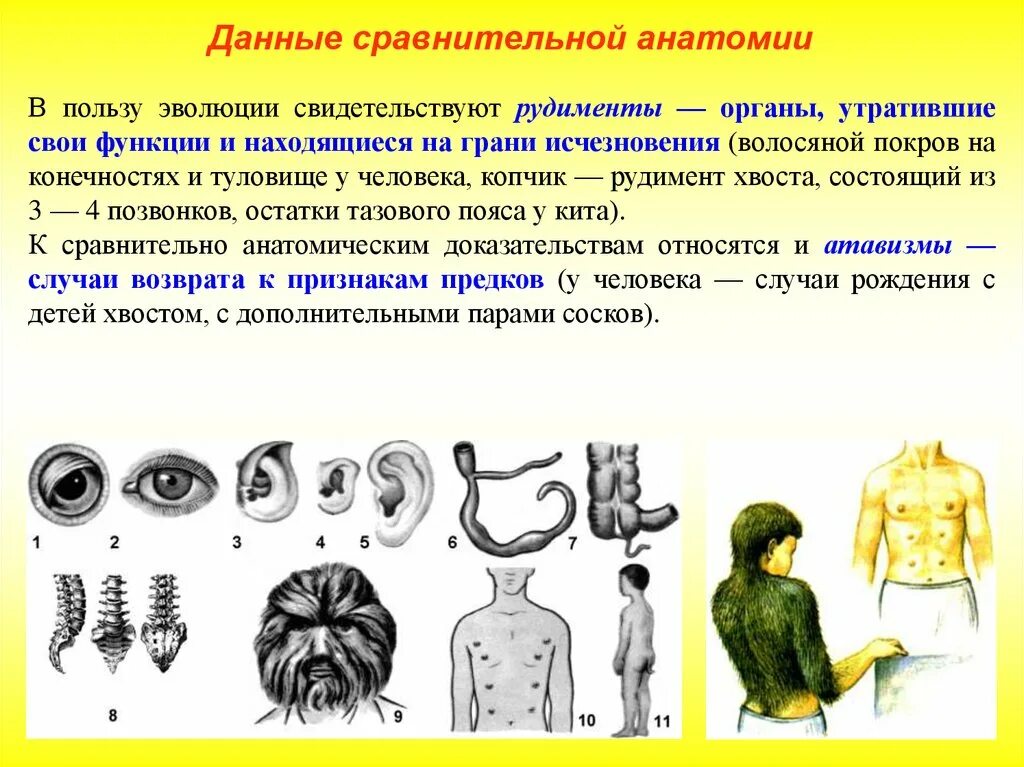 Атавизмы доказательства эволюции. Рудименты тела человека. Рудименты и атавизмы человека таблица. Атавизмы и рудименты человека.