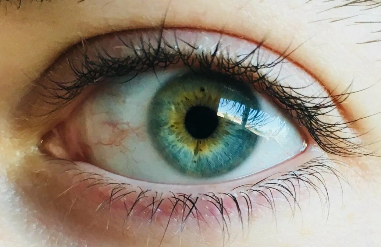 Зелено голубо желтые глаза. Хейзел цвет глаз голубо-зеленый. Центральная гетерохромия карих глаз. Гетерохромия Радужки глаз. Центральная гетерохромия серых глаз.