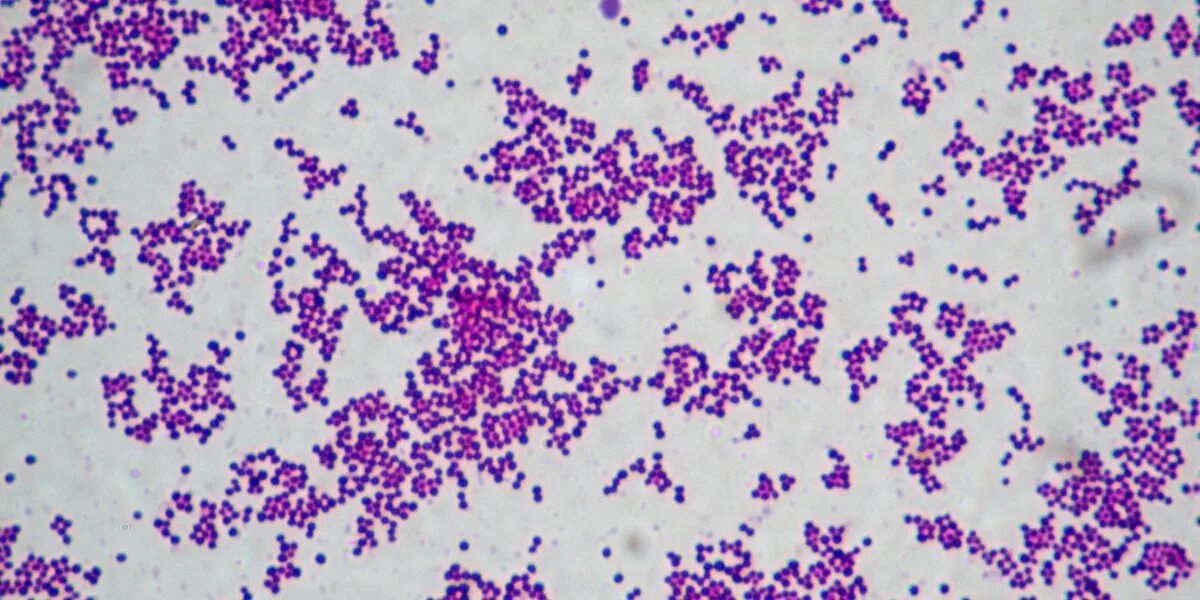 Staphylococcus aureus 10 4