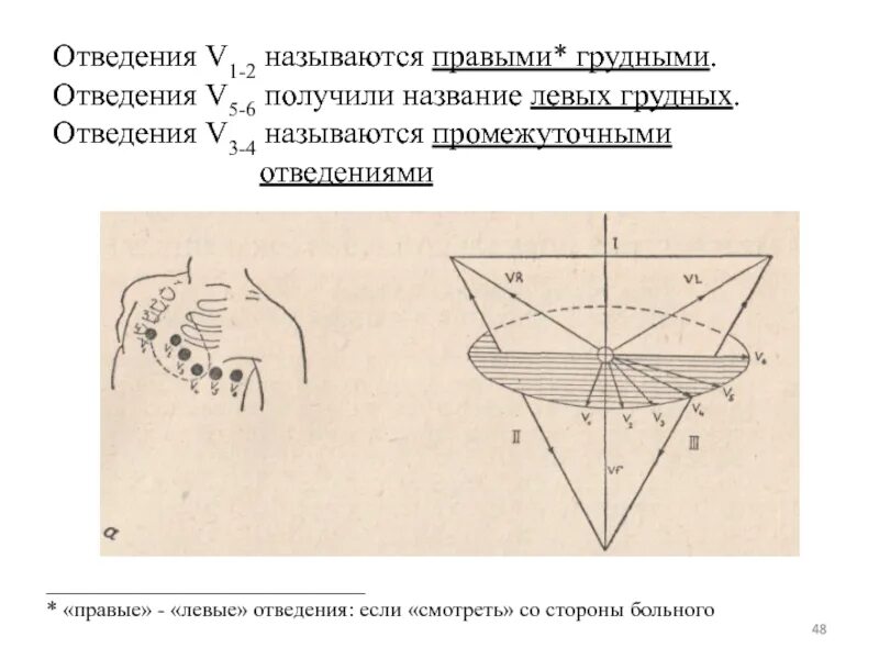 Правые и левые отведения на ЭКГ. Левые отведения ЭКГ. Левые грудные отведения на ЭКГ. Правые и левые грудные отведения. Правые грудные отведения