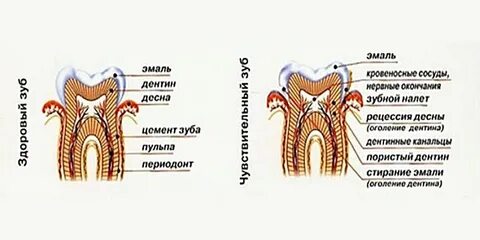 Чувствительность пульпы