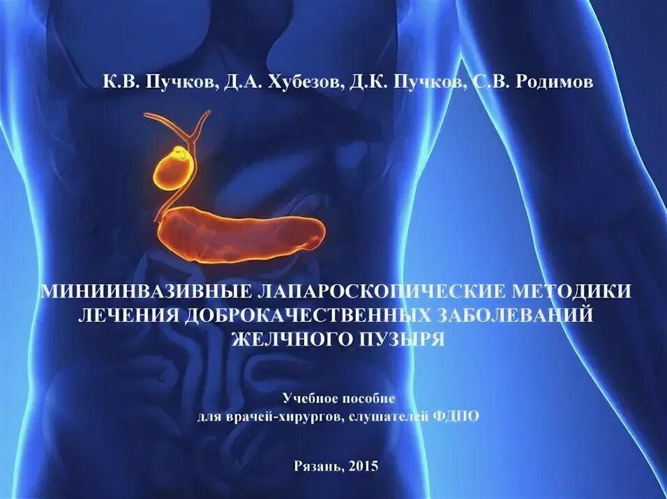 Народное лечение полипа в желчном пузыре. Лекарство от полипов в желчном. Лекарства от полипов в желчном пузыре. Аденоматозный полип желчного пузыря.