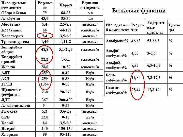 ЛДГ анализ крови норма. ЛДГ норма у детей по возрасту. Нормальные показатели ЛДГ В крови. Анализ крови ЛДГ норма у женщин таблица.